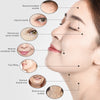 Tripolar Machine Skin Tightening Rejuvenation Facial